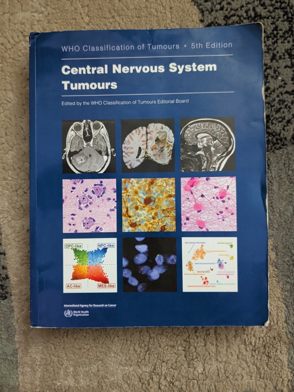 Central Nervous System Tumours: WHO Classification of Tumours 5th Edition