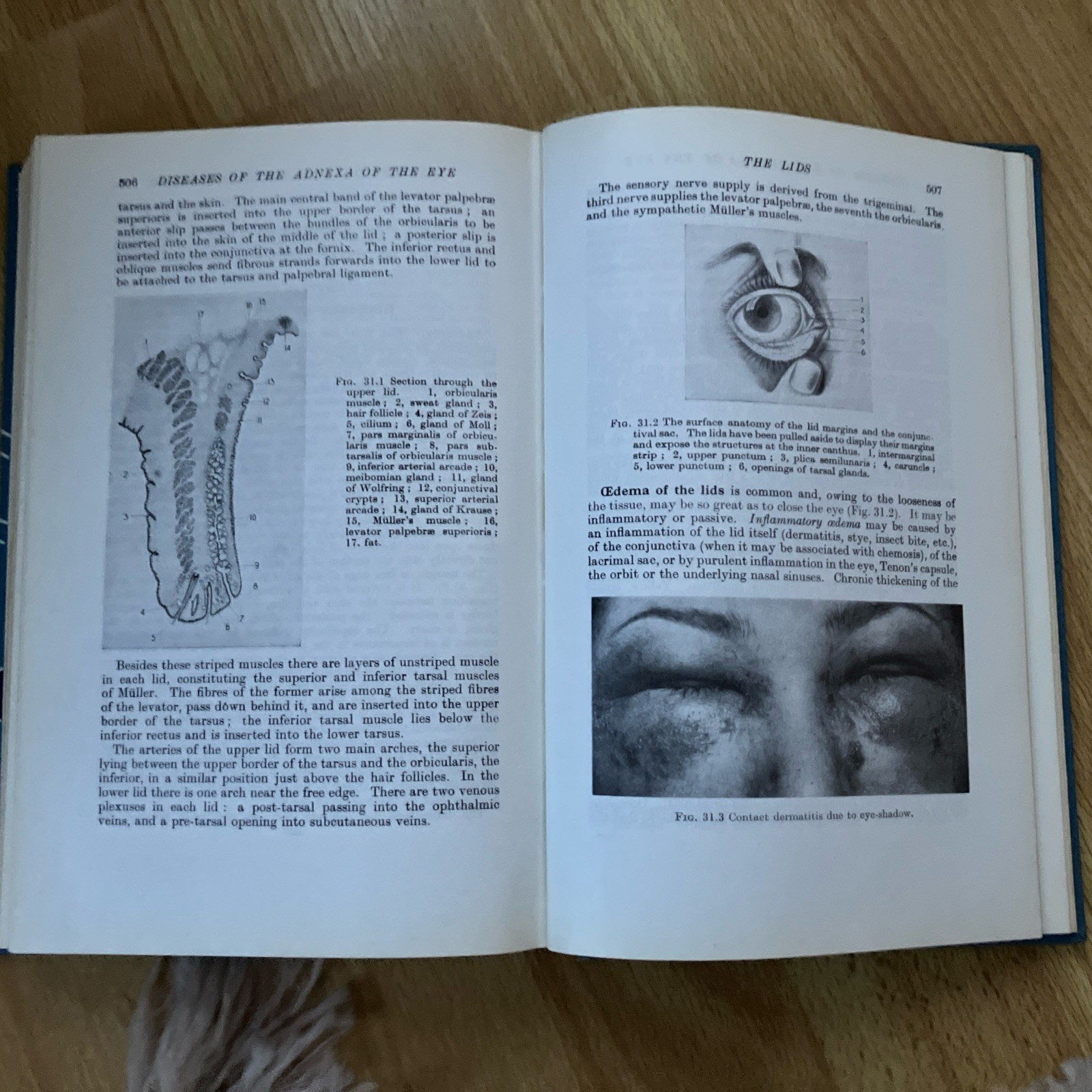 Parsons’ Diseases of the Eye vintage textbook hardback by S. Miller 1978 16th