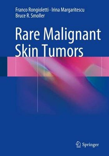 Rare Malignant Skin Tumors by Franco Rongioletti: New