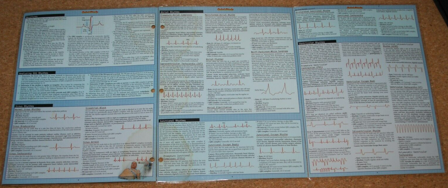 EKGS / ECGS (QUICK STUDY: ACADEMIC) By Inc. Barcharts **SEE DESCRIPTION, PICS**