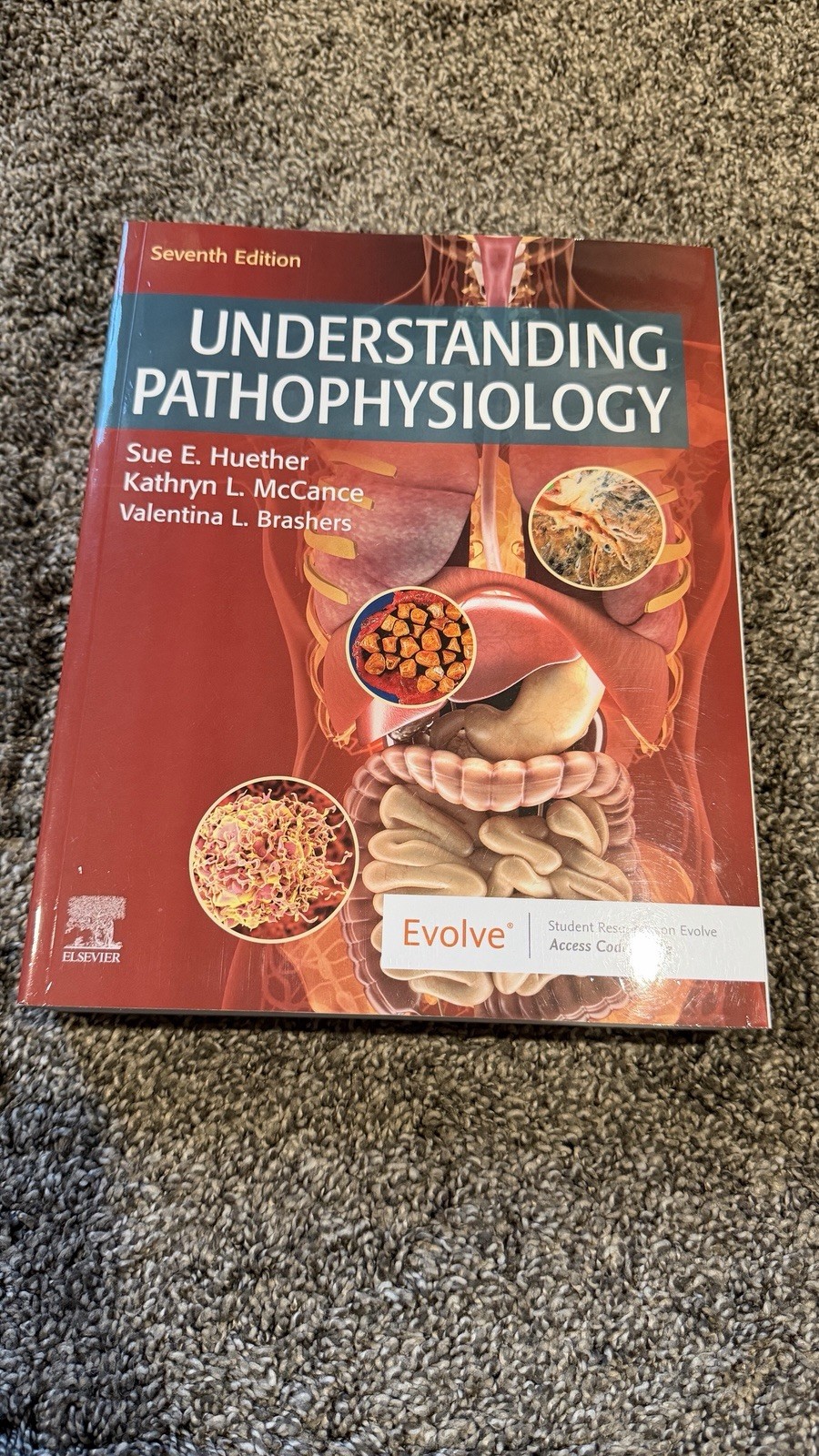 Understanding Pathophysiology Kathryn L. McCance