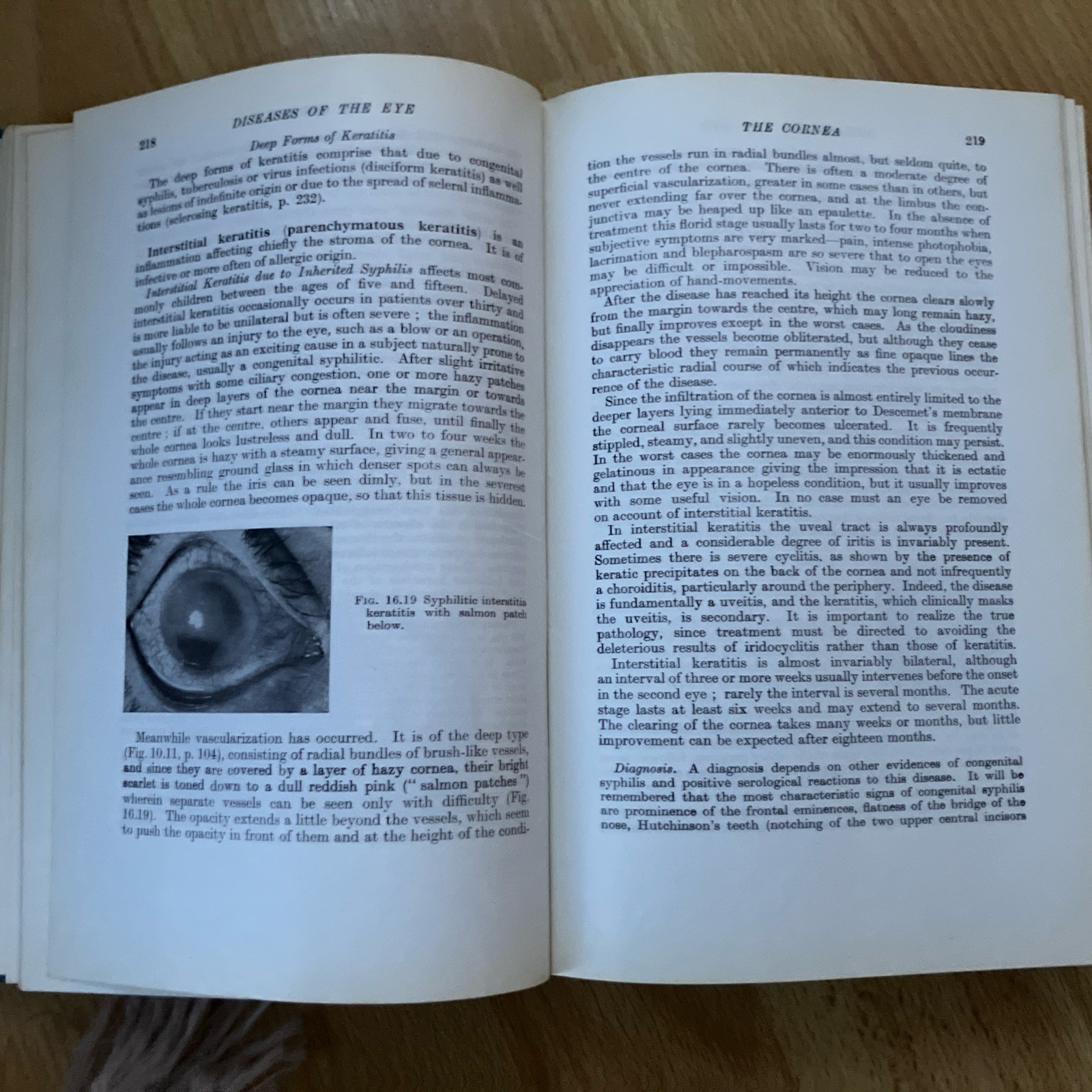 Parsons’ Diseases of the Eye vintage textbook hardback by S. Miller 1978 16th
