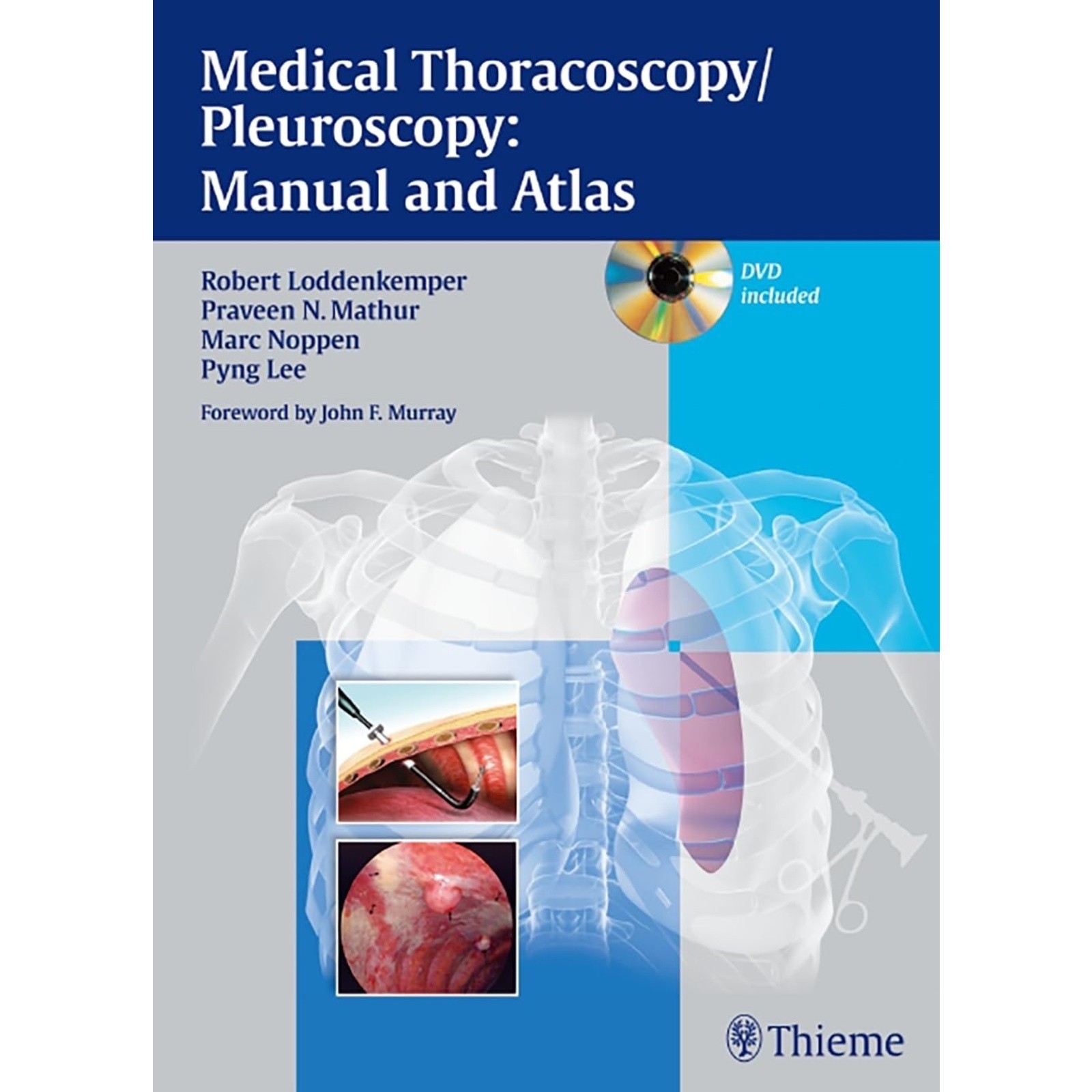 Medical Thoracoscopy/pleuroscopy by Robert Loddenkemper (2010)