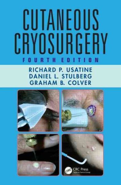 Cutaneous Cryosurgery, Hardcover by Usatine, Richard P., M.D.; Stulberg, Dani…