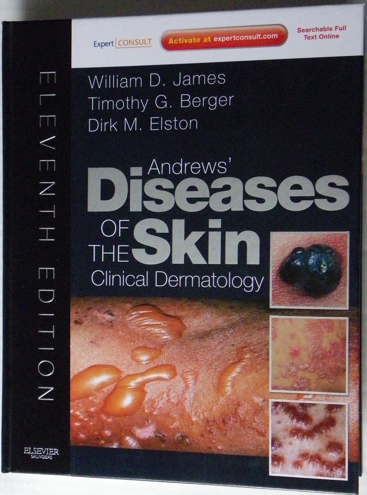 Andrews’ Diseases of the Skin: Clinical Dermatology – Expert Consult – Onlin…
