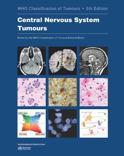 Who Classification of Tumours Ser.: Central Nervous System Tumours by WHO…