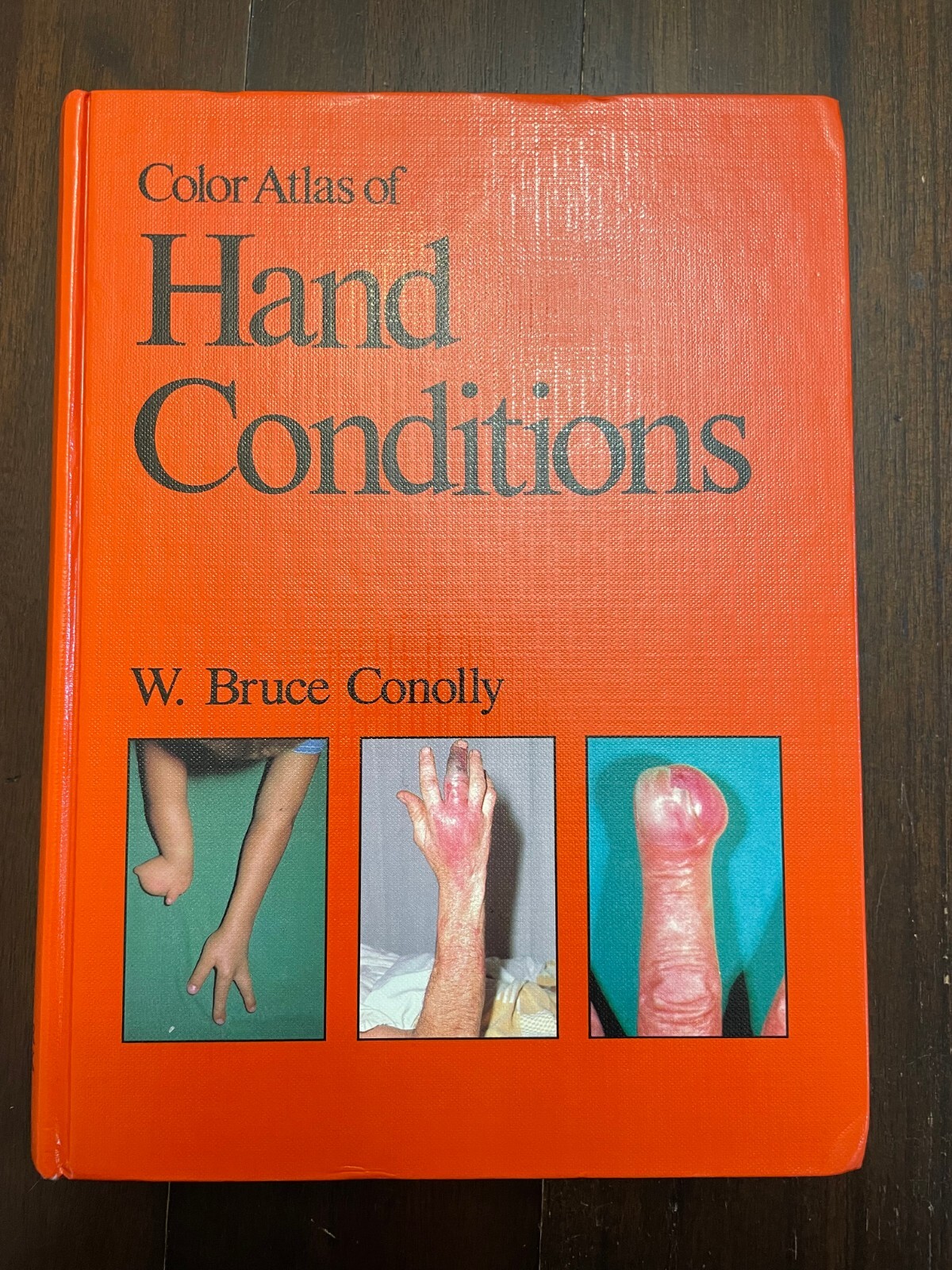 A COLOUR ATLAS OF HAND CONDITIONS By W. Bruce Conolly – Hardcover