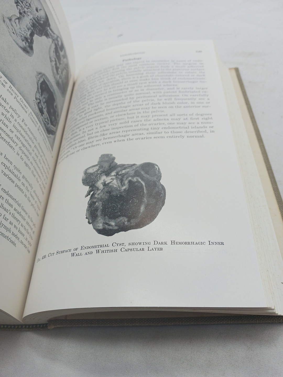 Novak’s Textbook of Gynecology 5th edition 1956 Emile Novak HARDCOVER HC – RARE