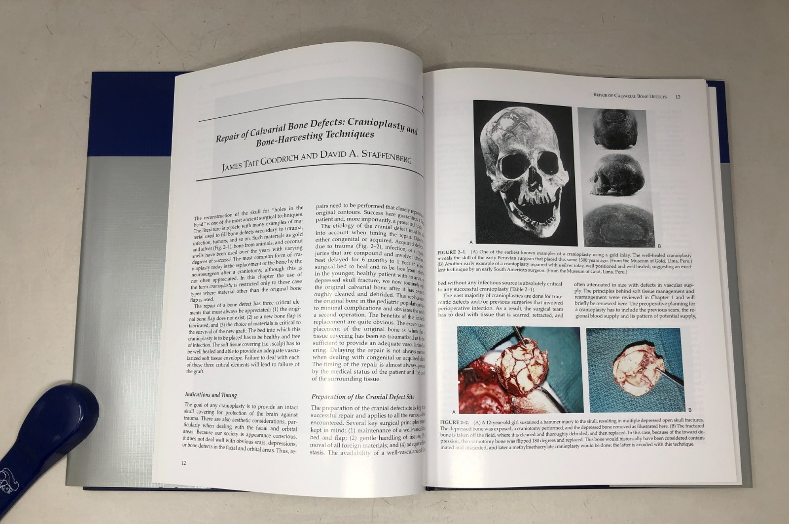 Plastic Techniques in Neurosurgery, 2004, E-122