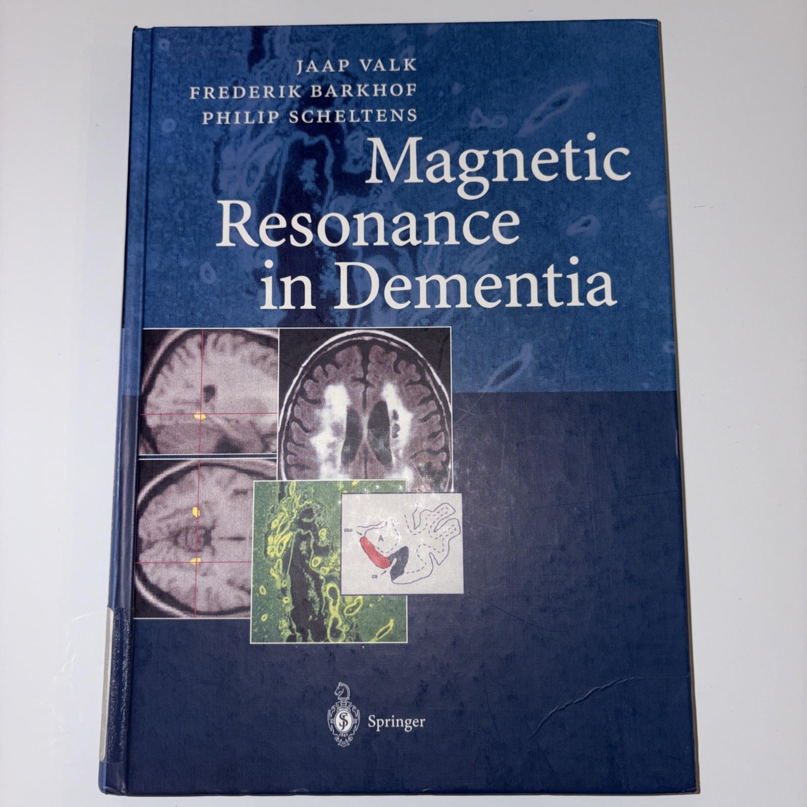 Magnetic Resonance in Dementia by Jaap Valk, Philip Scheltens and Frederik…