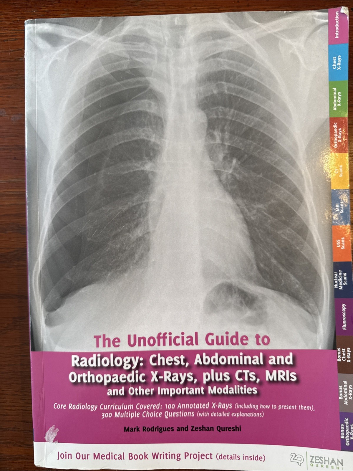 Unofficial Guides: Unofficial Guide to Radiology : Chest, Abdominal and…