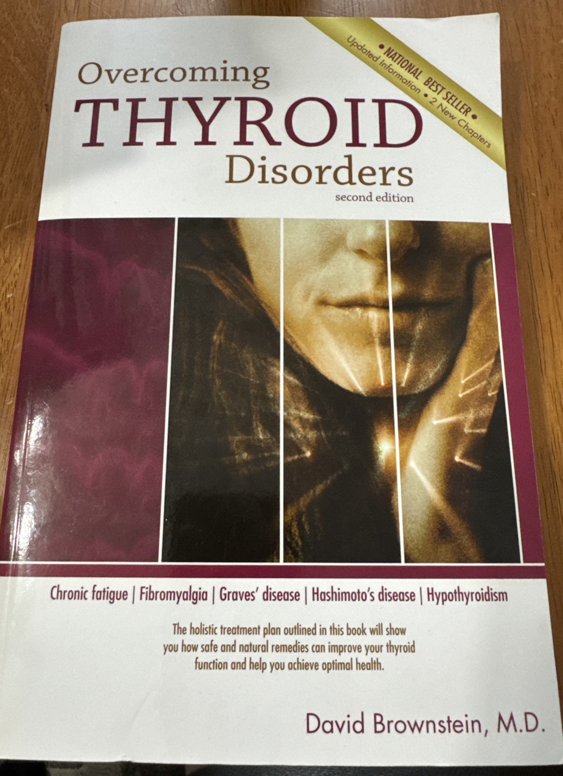 Overcoming Thyroid Disorders by Brownstein, David (2002) Paperback – paperba…