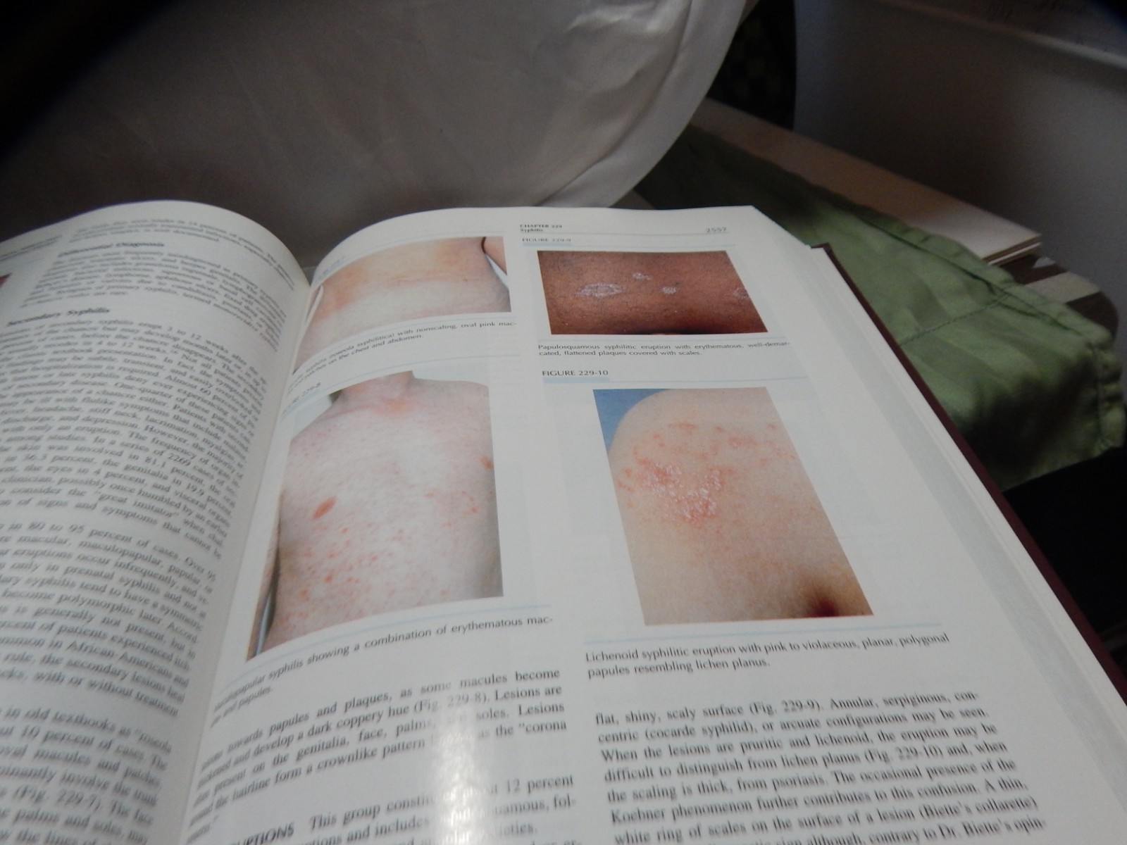 Fitzpatrick’s Dermatology in General Medicine 5th Edition Volumes 1 & 2 HC
