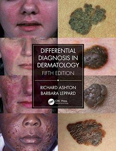 Differential Diagnosis in – Paperback, by Ashton Richard; Leppard – Very Good