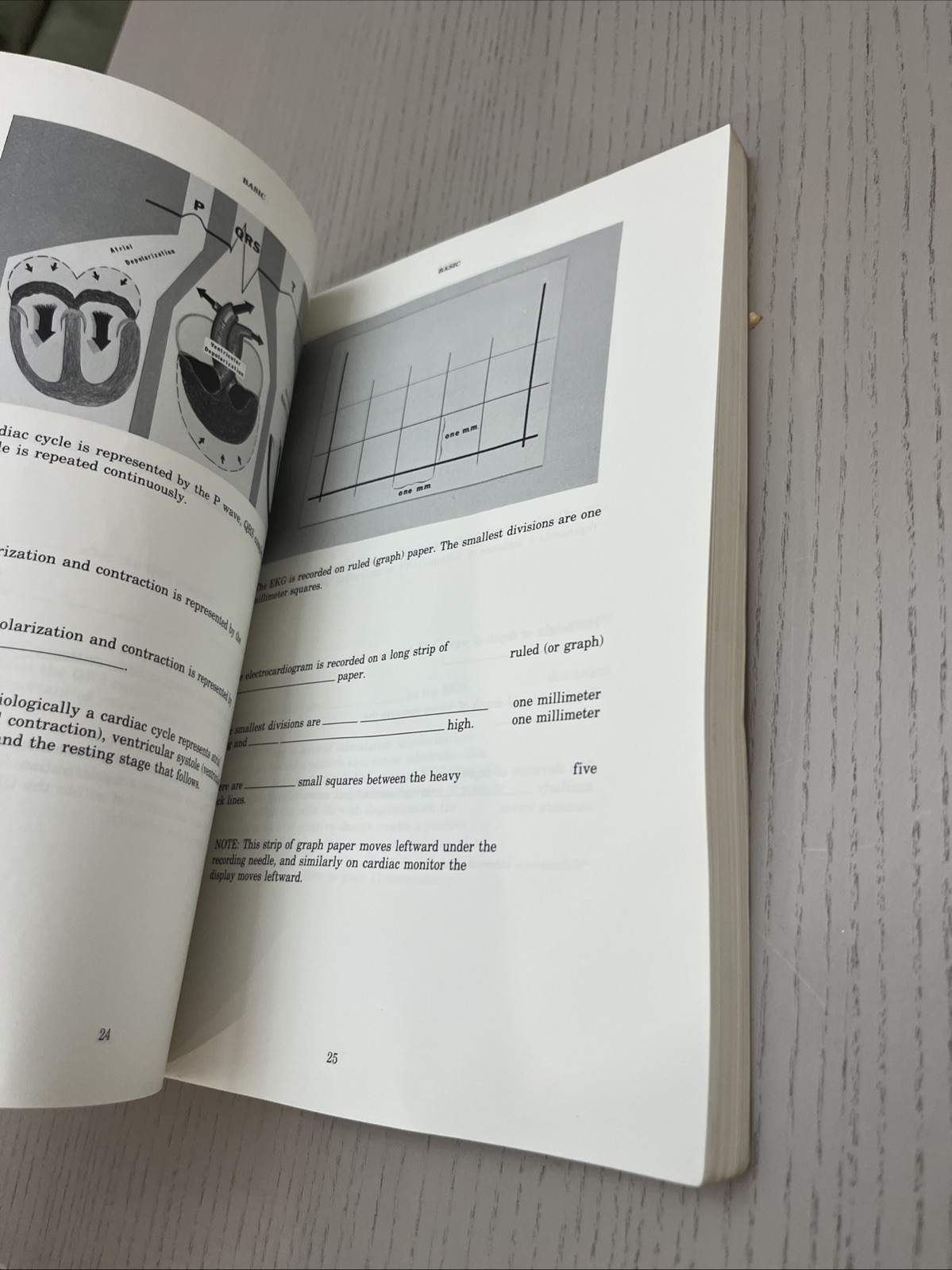 Rapid Interpretation of EKG’s by Dale Dubin 4th edition