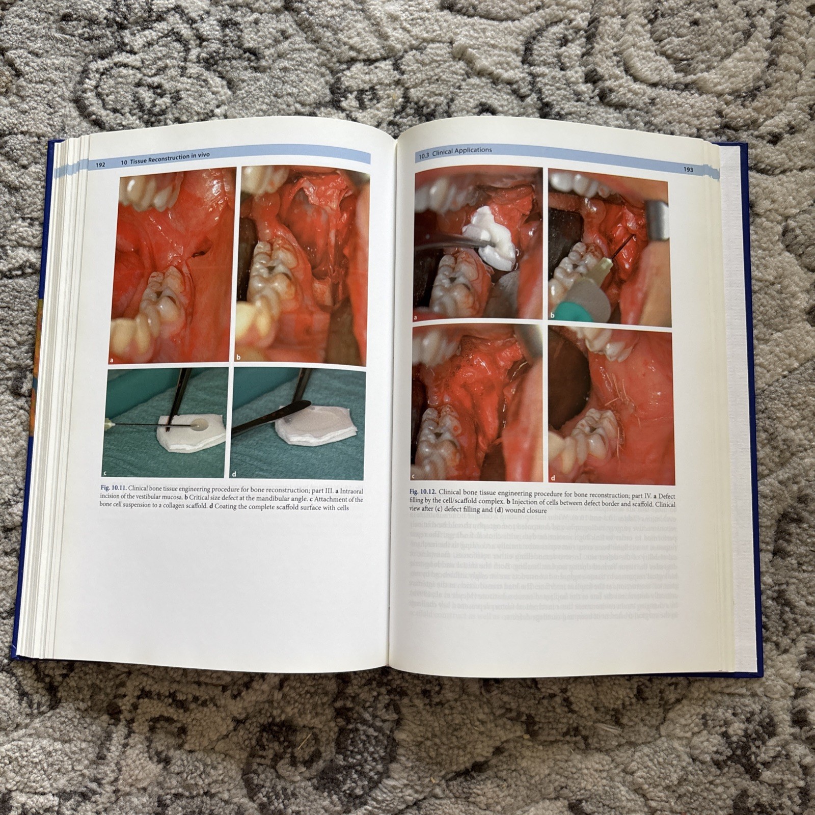 Bone and Cartilage Engineering by Ulrich Meyer and Hans Peter Wiesmann