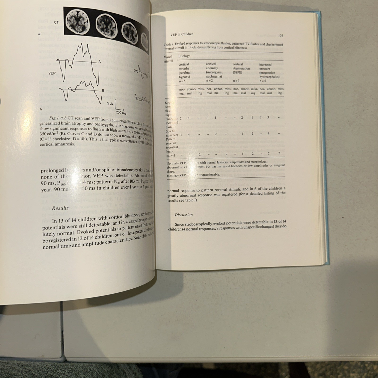 Developments in Ophthalmology Special Tests of Visual Function byZrenner (1984)