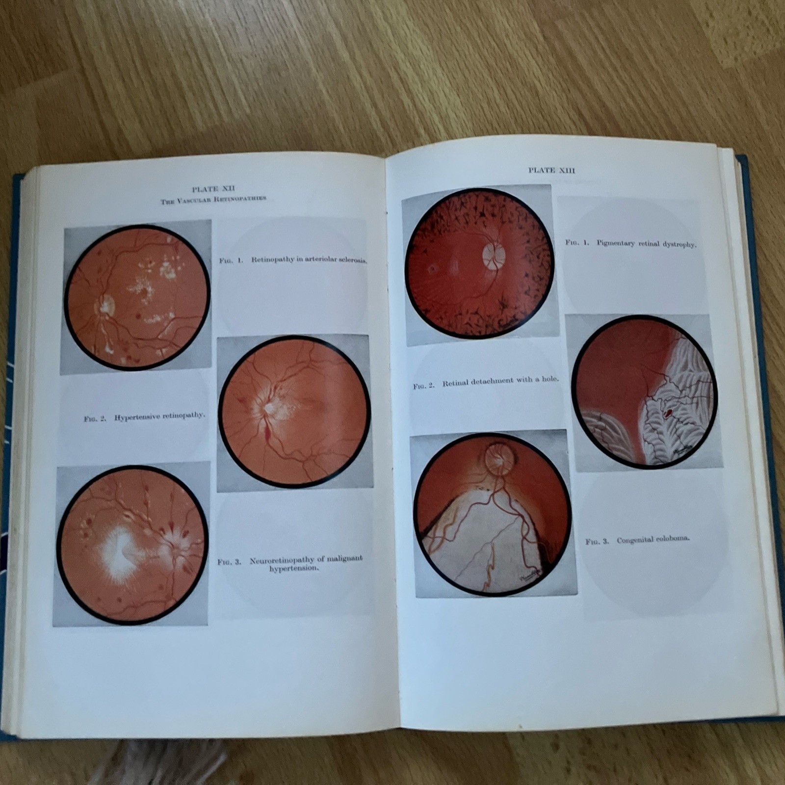 Parsons’ Diseases of the Eye vintage textbook hardback by S. Miller 1978 16th