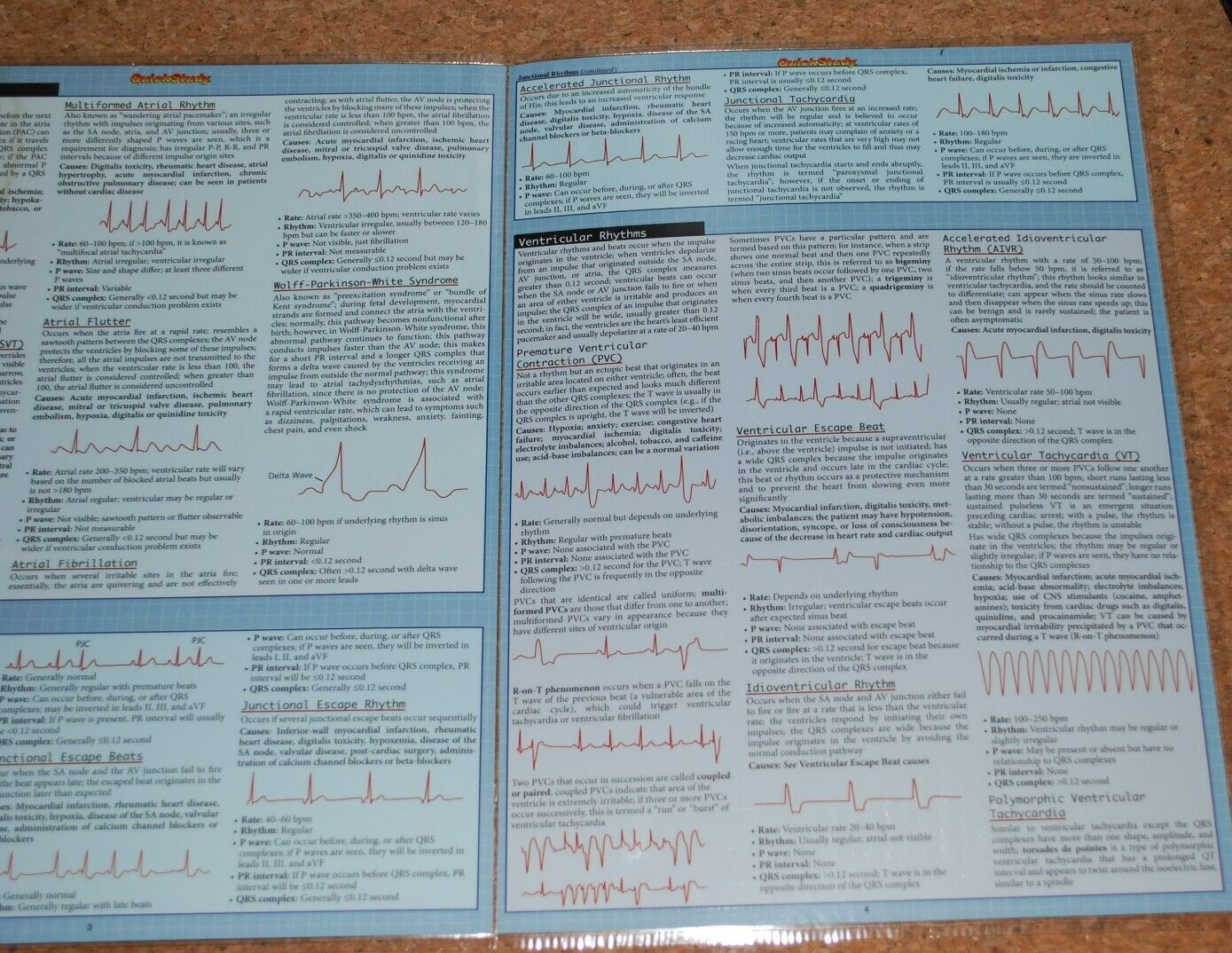 EKGS / ECGS (QUICK STUDY: ACADEMIC) By Inc. Barcharts **SEE DESCRIPTION, PICS**