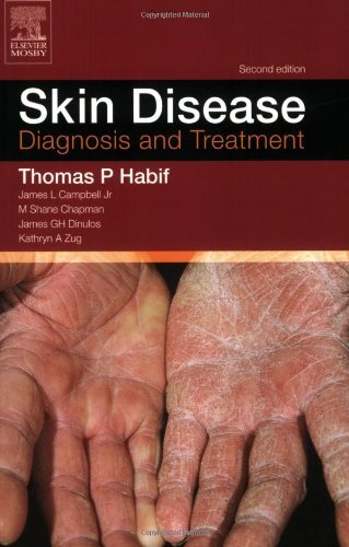 Skin Disease,: Diagnosis and Treatment, Thomas P. Habif