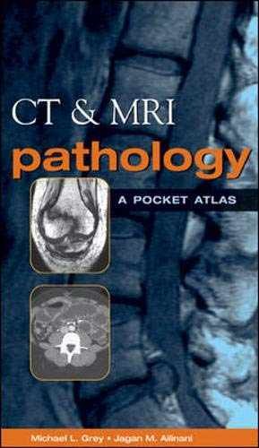 CT & MRI Pathology: A Pocket Atlas – Paperback, by Michael L. Grey; – Very Good