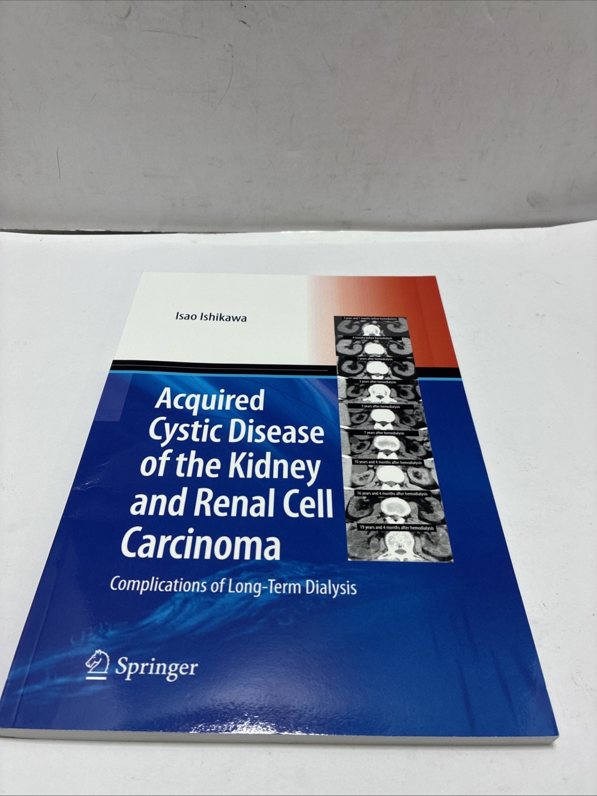Acquired Cystic Disease of the Kidney and Renal Cell Carcinoma: Complication of
