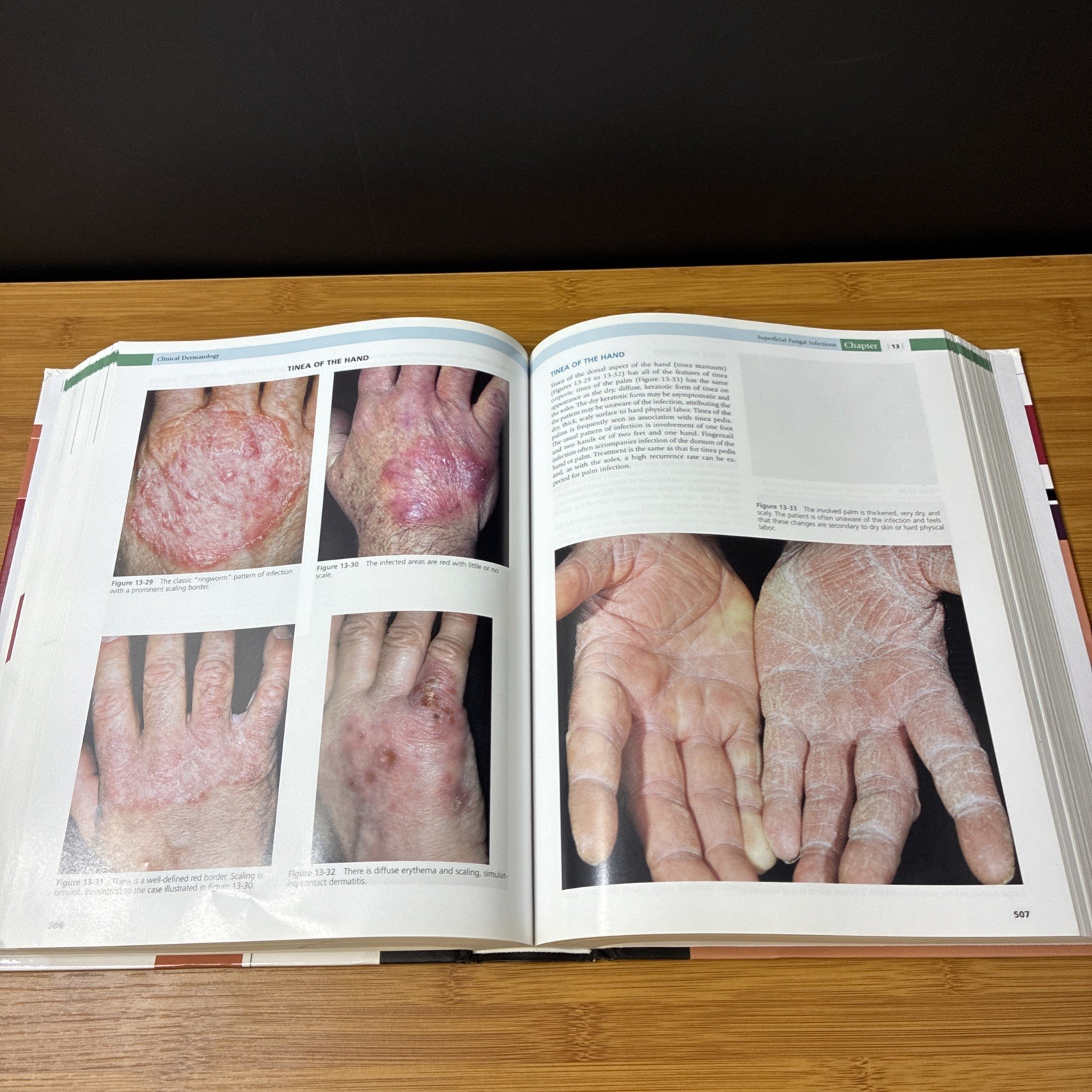 Clinical Dermatology Color Guide to Diagnosis & Therapy 5th Ed Thomas Habif 2010