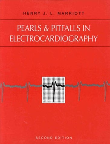 Pearls & Pitfalls in Electrocardiography : Pithy, Practical Pointers