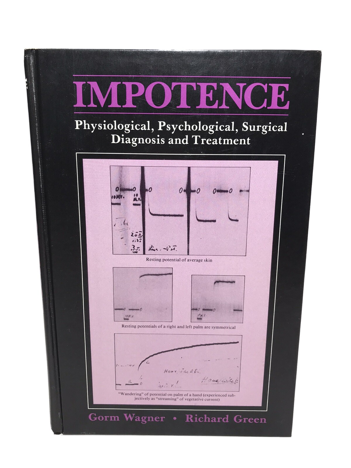 Impotence Physiological Psychological Surgical Diagnosis & Treatment by Wagner
