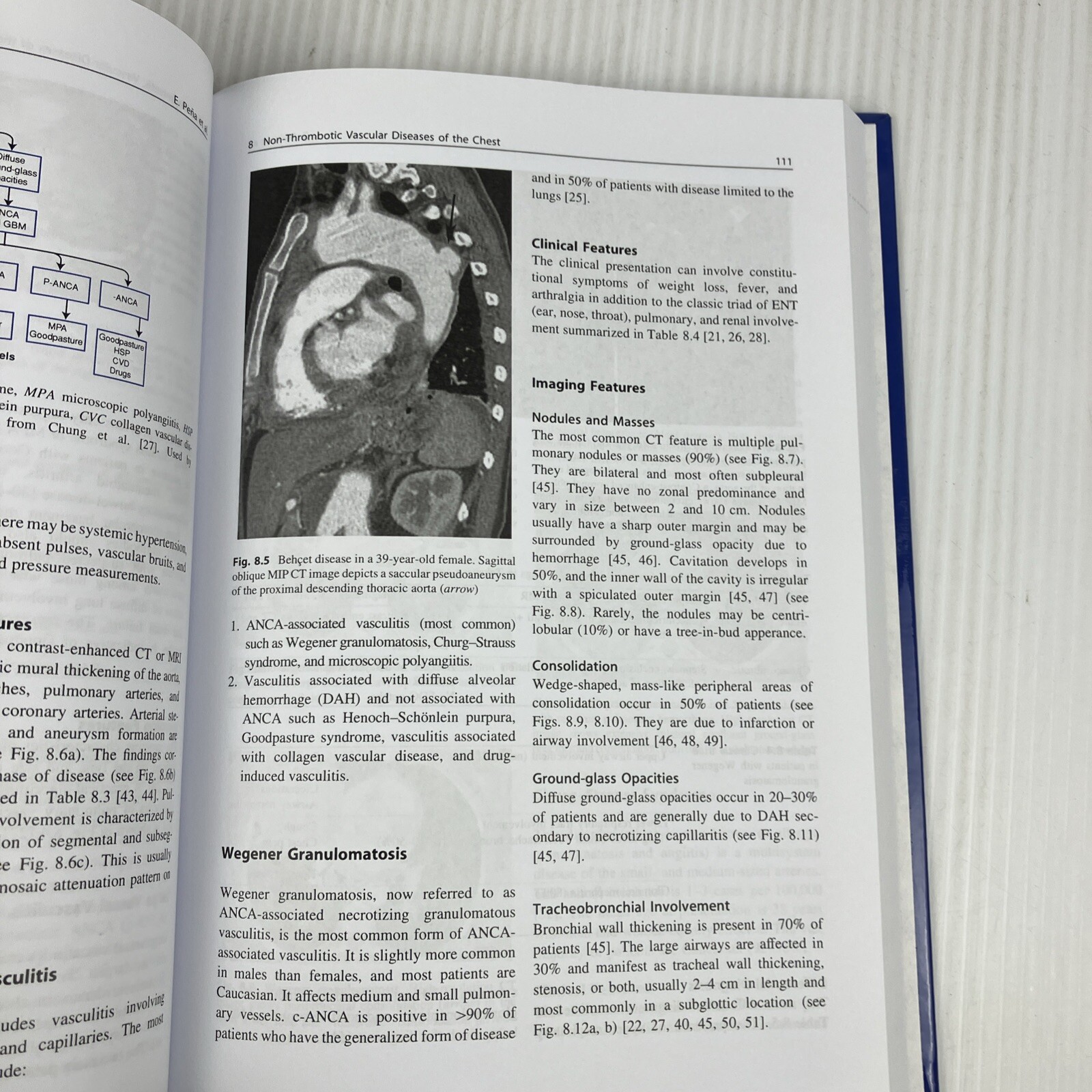 Clinically Oriented Pulmonary Imaging by Jeffrey Kanne Respiratory Medicine HC